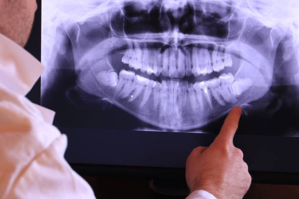 Best Emergency Root Canal Treatment in Avilla, AR