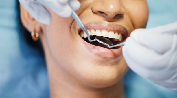 Best Broken or Cracked Tooth Emergency Dentist in Avilla, AR