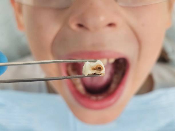 Fast & Reliable Emergency Dental Services in AR
